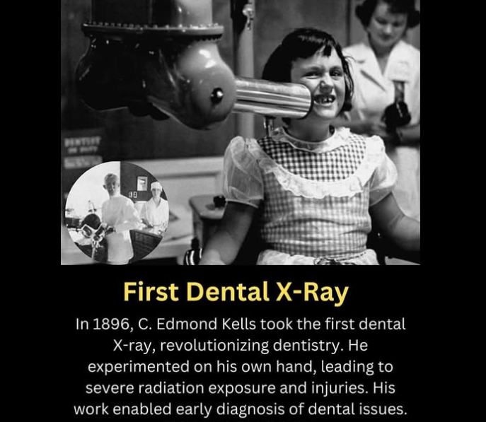 Первое использование рентгена в стоматологии